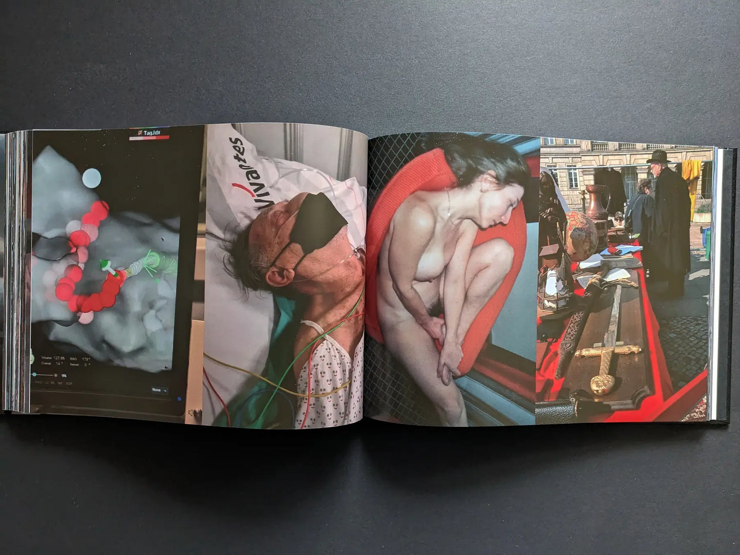 Medical monitor, a patient in hospital, a nude woman curled on a bed, and a market stall with a sword.