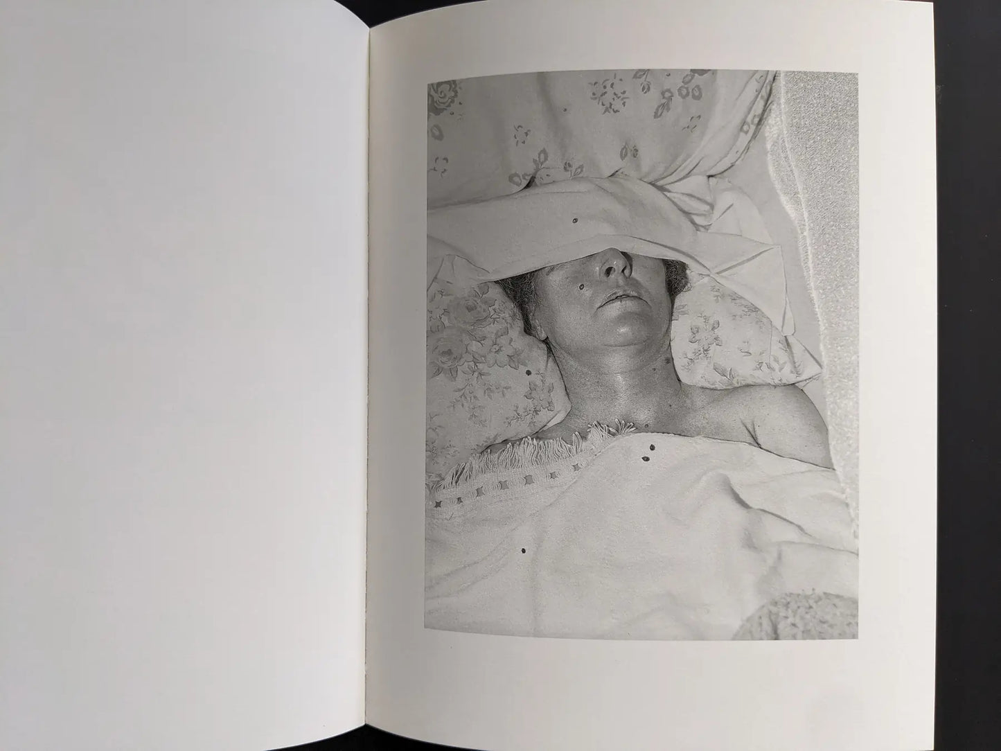 Grayscale portrait of a sleeping person with a cloth over the eyes.