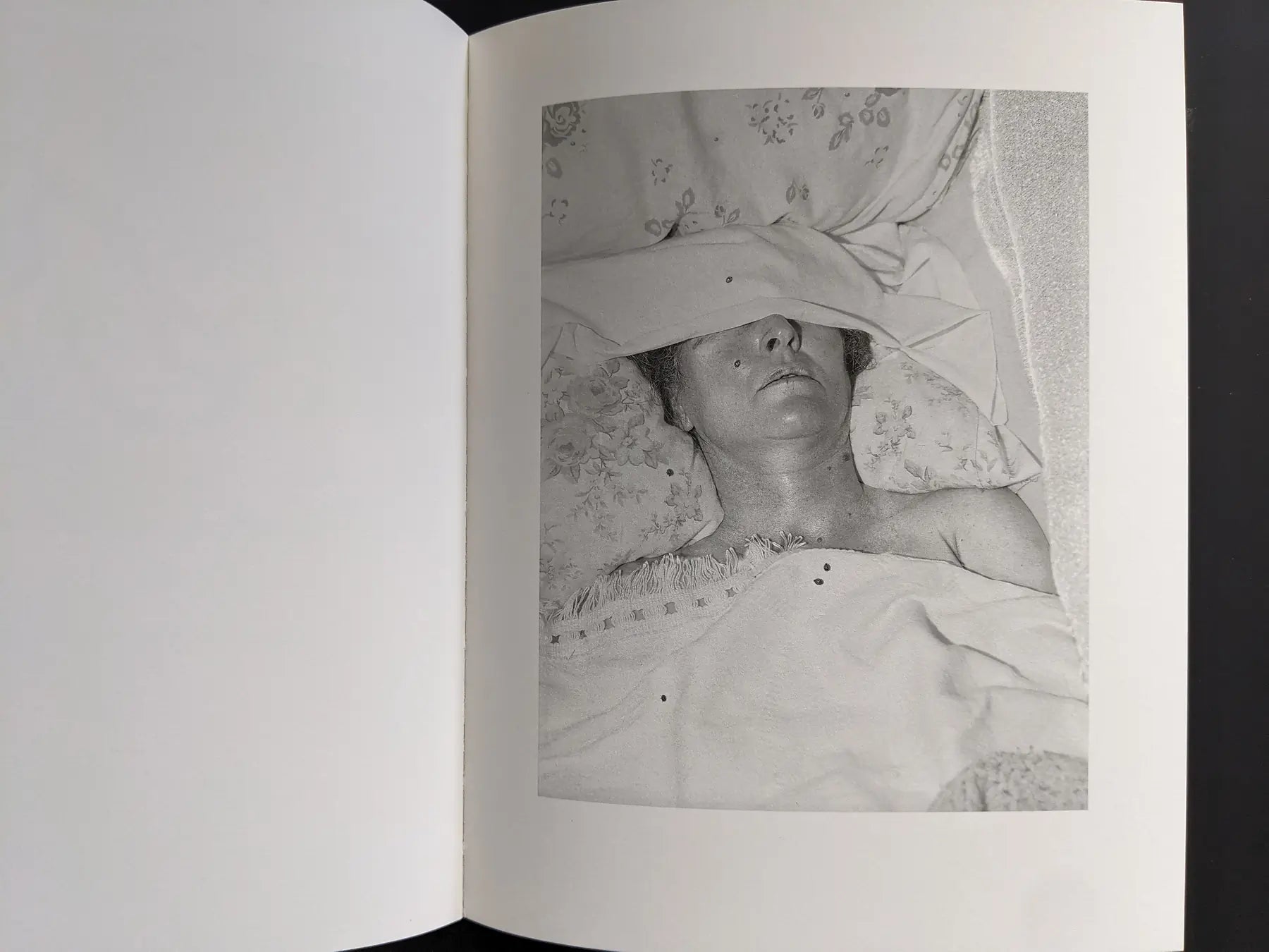 Grayscale portrait of a sleeping person with a cloth over the eyes.